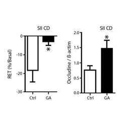 Schéma effets de Fibregum™