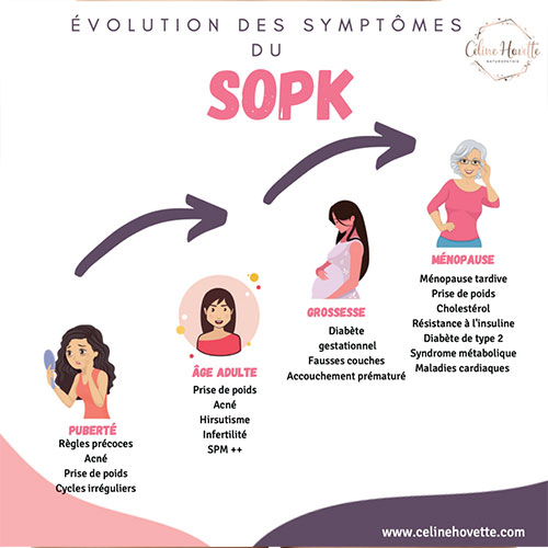 L'évolution du SOPK au cours de la vie de la femme