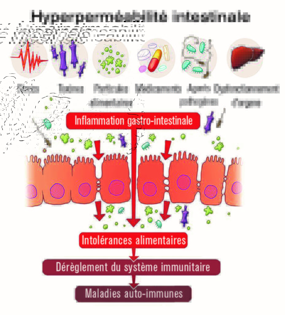 schema hyperpermeabilite intestinale inflammation maladie