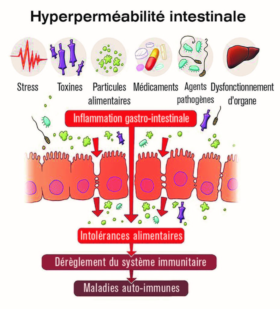 schema intestin permeabilité intestinale