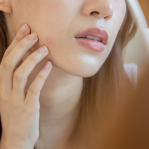 altérations cutanées