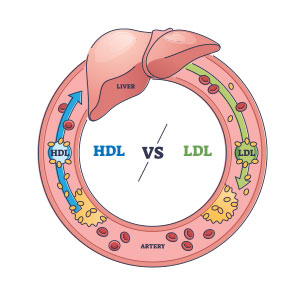 HDL et LDL