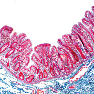 Immunité intestinale